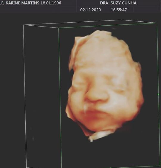 Karine Staehle Paul Staehle Baby Ultrasound Instagram